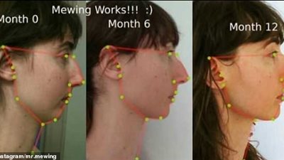 «اللسان» أحدث صيحة لشد الوجه بدون عمليات جراحية (صور)