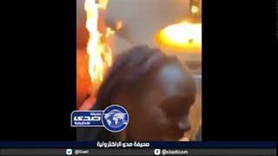 «حلق ولاعة» يتسبب في إشعال النار بشعر فتاة (فيديو)