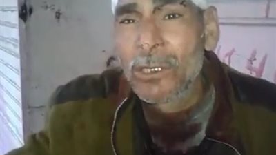 بالصور.. مواطن بالإسماعيلية يتهم ضابطا بالاعتداء عليه وإصابته بـ21 غرزة