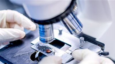 الصحة.. وزارة «تعطيل الأبحاث».. «الروتين» يعرقل أحدث علاجات السرطان وتليف الكبد والتقزم.. والباحثون في المركز القومي للبحوث يستغيثون لإنقاذ دراساتهم من الموت في «أدراج الحكومة