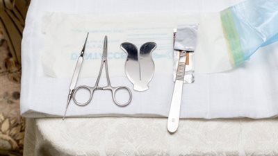 أبوان يتسببان في وفاة طفلهما بعد إجراء عملية ختان في المنزل