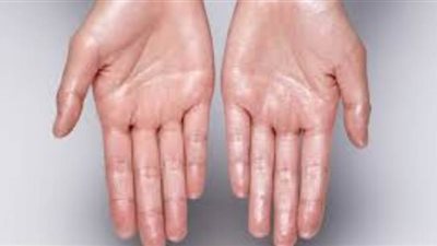 4 مواد طبيعية تساعد في علاج تعرق اليدين