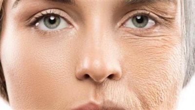 استشاري أمراض جلدية توضح الفرق بين البوتكس والفيلر التجميلي