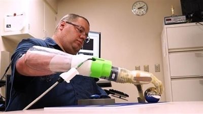 ذراع روبوتية ثورية تحركها أفكار المريض