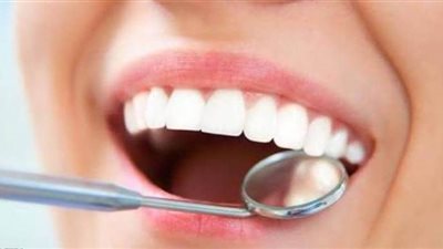 4 تعليمات قبل وبعد تبييض الأسنان عند الطبيب