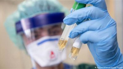 جهود دولية لمحاصرة كورونا.. أمريكا تبدأ تطوير لقاح.. الصين تجري تجارب سريرية أواخر أبريل.. وتجارب على لقاح إنفلونزا الطيور في مصر