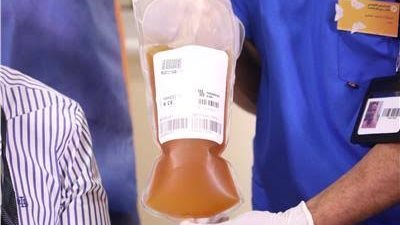 هل يُمنع مريض السكر من التبرع ببلازما الدم؟