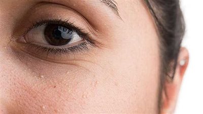 طرق التخلص من الحبوب الصغيرة في الوجه