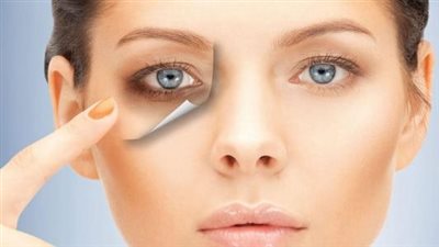 أسباب الإسمرار تحت العين وطرق العلاج