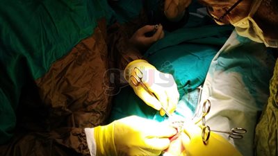 استئصال ورم بالحنجرة لأول مرة بمستشفى التأمين الصحي ببنها