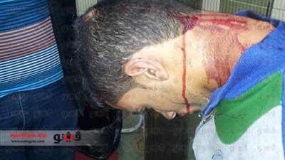 بالصورة.. طلاب الإرهابية يعتدون على زميلهم بالمطواة بجامعة المنصورة