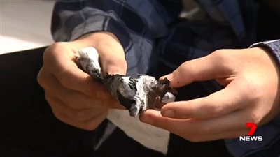 انفجار بطارية «آيفون 6» في وجه مراهق (فيديو وصور)