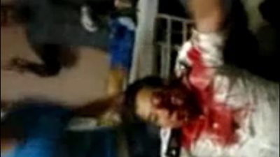 بالفيديو.. إصابة نائب مأمور قسم بولاق برصاص قناصى مليشيات الإخوان