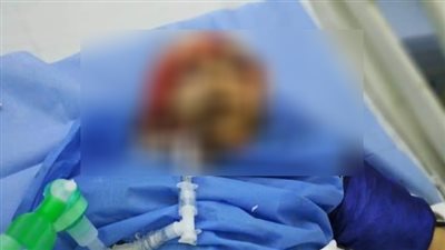 تفاصيل ضحية لعب الكرة في شبرا الخيمة.. عيار طائش يصيب 