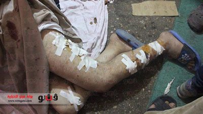 توزيع مصابي 