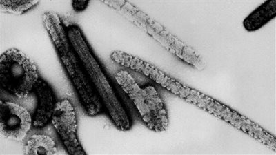 بالدم والأغشية.. كيف ينتقل فيروس ماربورج الفتاك |فيديو 