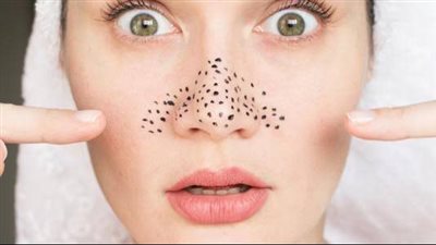 قناع «الكربوناتو» يخلصك من الرؤوس السوداء في 20 دقيقة فقط