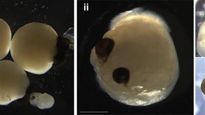 علماء يتوصلون لتطوير دماغ بدائي أنتج أعينا بشرية متماثلة في المختبر