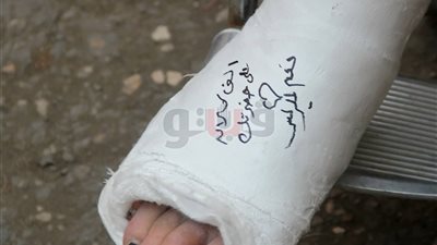سيدة بـ«رجل مكسورة» تدلي بصوتها وتكتب على الجبس «نعم للرئيس» (صور)