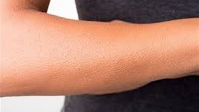 تفسير رؤية الجلد في المنام وعلاقتها بالإصابة بالأمراض وارتكاب المعاصي 