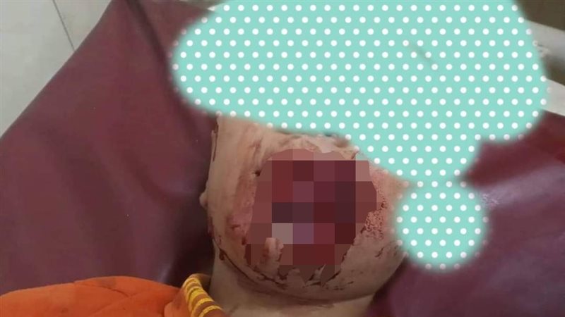 إحدى المصابات