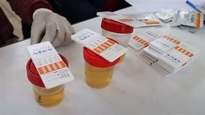 الصحة: إجراء تحليل المخدرات بالمعامل المركزية بدقة وسرية وحيادية تامة 