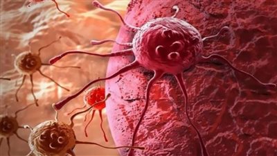 هل بوابات التفتيش تسبب الإصابة بالسرطان؟ استشارى يجيب|فيديو