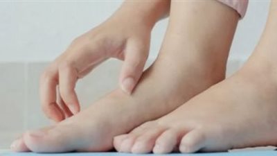 احذر تورم الساقين.. باحث بطب نيويورك: علامة لمشكلة كبيرة بالقلب والكبد والكلي