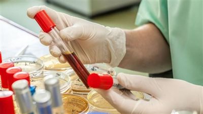 أوروبا تسجل 188 إصابة بشرية بفيروس غرب النيل خلال 2022