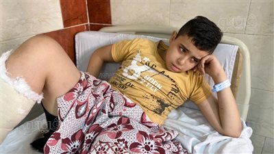 مأساة الطفل رامي أحد مصابي حريق كنيسة أبو سيفين: مش لاقي أمي وأخويا | فيديو وصور