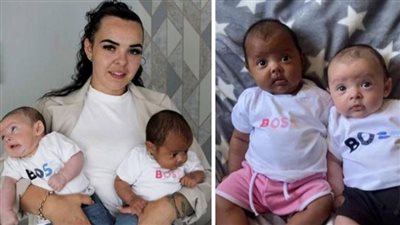 تحدث مرة في المليون.. بريطانية تنجب توأما بلوني بشرة مختلفين تماما
