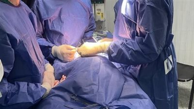 مستشفى سوهاج الجامعي تجري عملية جراحية لبناء ملامح وجه طفلة من اليمن 