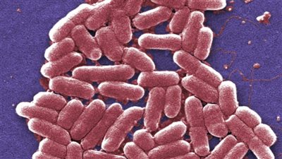 إصابة العشرات ببكتيريا 