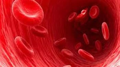 أعراض الأنيميا وأسبابها وطرق العلاج والوقاية