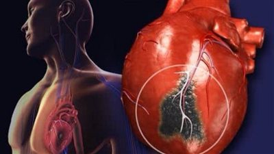 زيادة النوم وقلة الحركة.. دراسات تحدد علامات الموت وقرب نهاية الأجل 