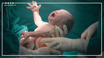  أرقام عن الولادات القيصرية في مصر | إنفوجراف
