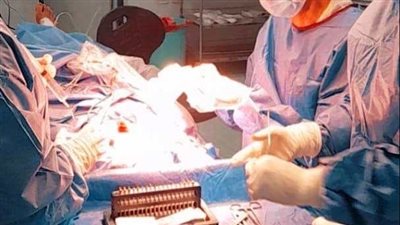 للقضاء على قوائم الانتظار.. إجراء 16 عملية زراعة قوقعة للأطفال بمستشفى الهلال بسوهاج