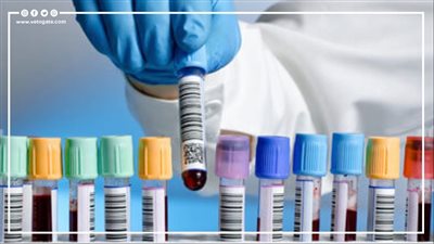 شروط الحصول على لقب دكتور بمجال التحاليل الطبية | إنفوجراف