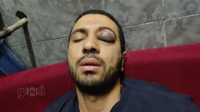 القبض على أهل مريض تعدوا بالضرب على فني أشعة بمستشفى المنشاوي بطنطا