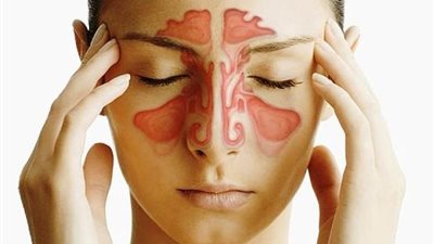علاج الجيوب الأنفية في المنزل بمواد طبيعية
