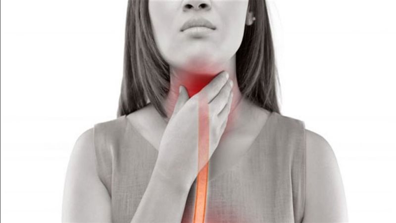 علاج حموضة المعدة