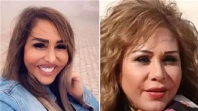 عملية تجميل غيرت شكلها تمامًا.. معلومات لا تعرفها عن مها المصري 