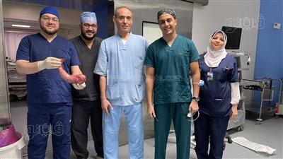 نجاح أول عملية تكميم معدة بالمنظار بمستشفى بني سويف التخصصي