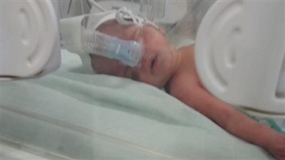 بعد وفاته في الحضانة.. والدي طفل ببني سويف يتهمان المستشفى بالإهمال الطبي