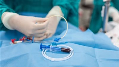 ما هي قسطرة القلب.. وأهم استخداماتها