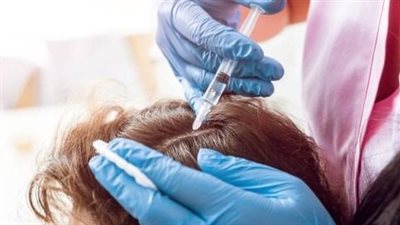 تحذير رسمي من دواء مغشوش لعلاج تساقط الشعر بالأسواق | مستند