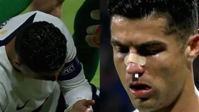 البرتغال تكتسح التشيك برباعية في دوري الأمم.. وإصابة دامية لرونالدو