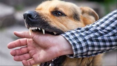 ماذا تفعل عند التعرض لعقر كلب لمنع الإصابة بمرض السعار؟ 