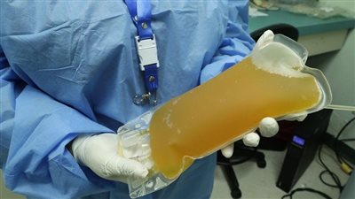 تعرف على عقوبة تصدير أو استيراد بلازما الدم بالمخالفة للقانون