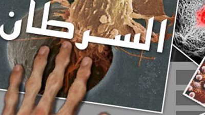 إنقاذ ثمانيني مصاب بـ4 أنواع من السرطان 